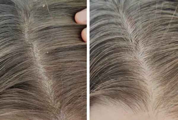 Apple cider vinegar hair rinse - Wild Nettle Hair Rinse - Image 3